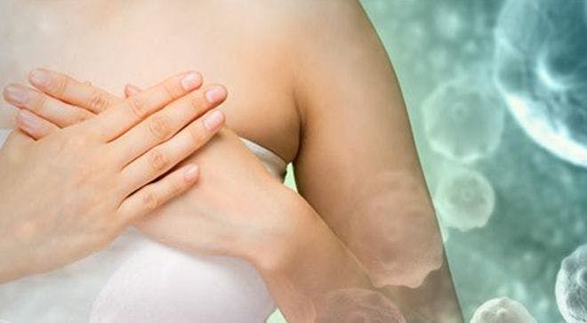 Image of a woman crossing her hands over her left breast.