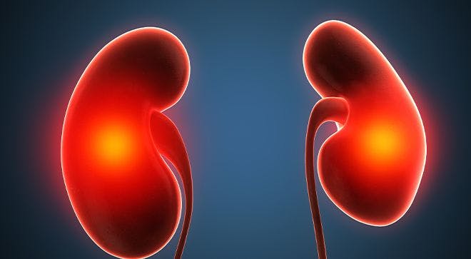 Illustration of kidneys with dots to depict tumors. 