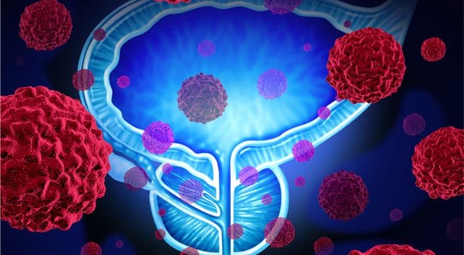 Illustration of prostate.