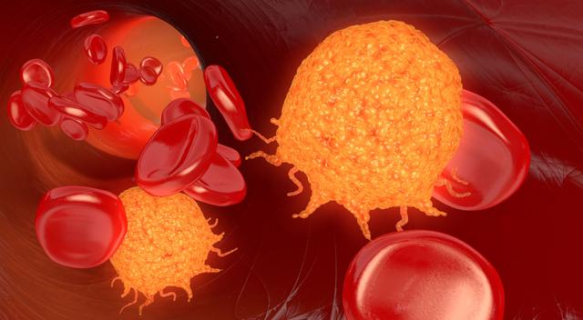 Illustration of tumor cells among red blood cells. 