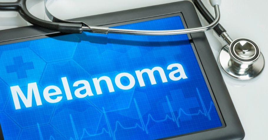 Image of a tablet screen that says "Melanoma."