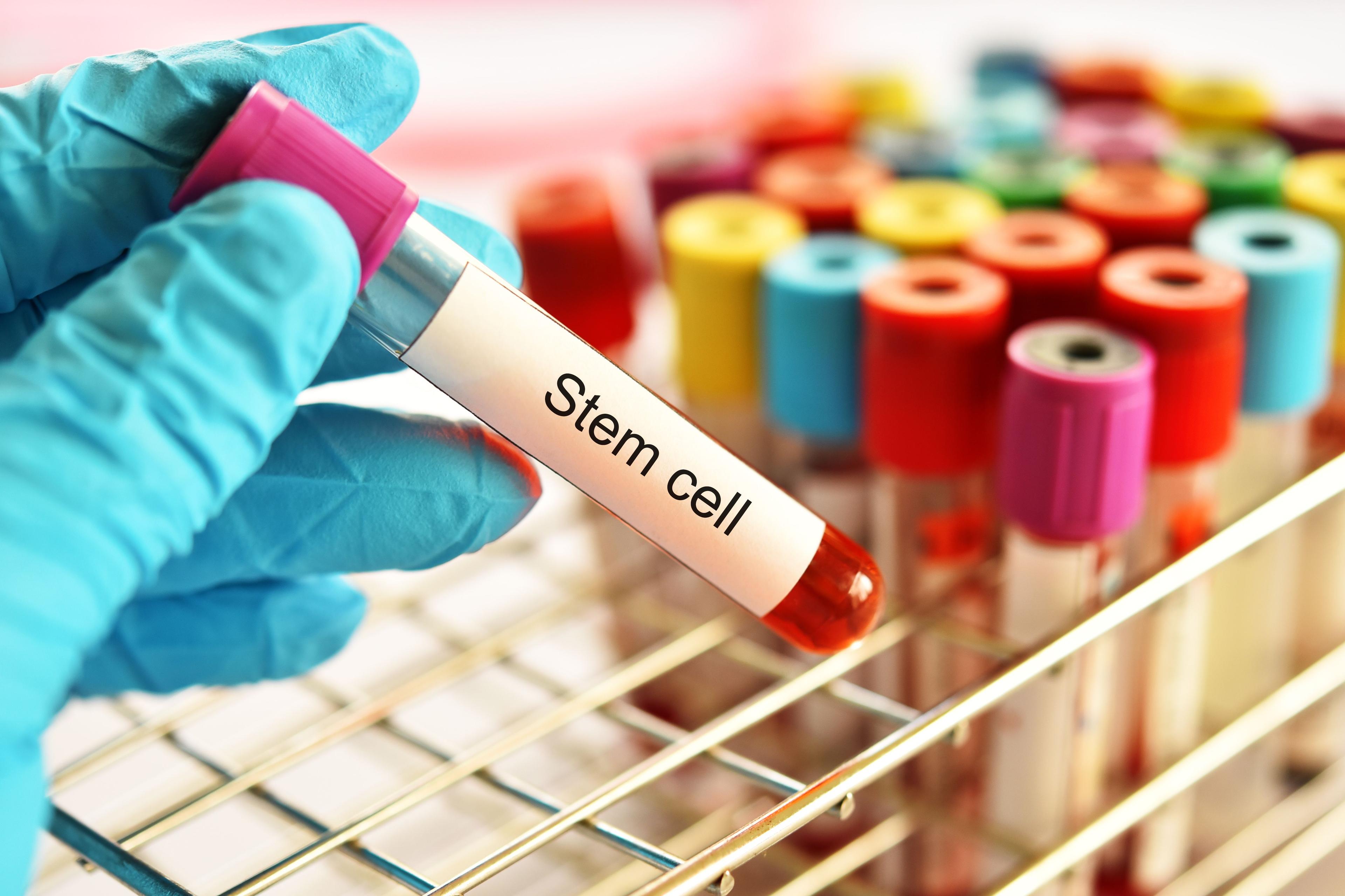 Blood sample tube contain with stem cell | Image credit: © jarun011 - © stock.adobe.com