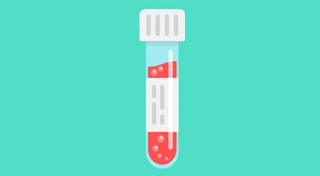 Image of a prostate-specific antigen test. 