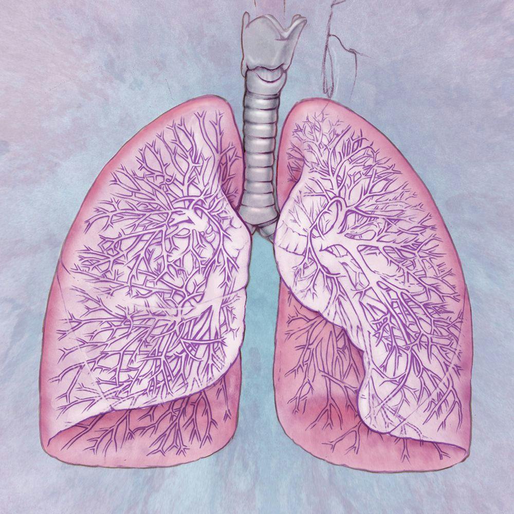 Opdivo Misses Endpoint in Phase 3 Lung Cancer Study